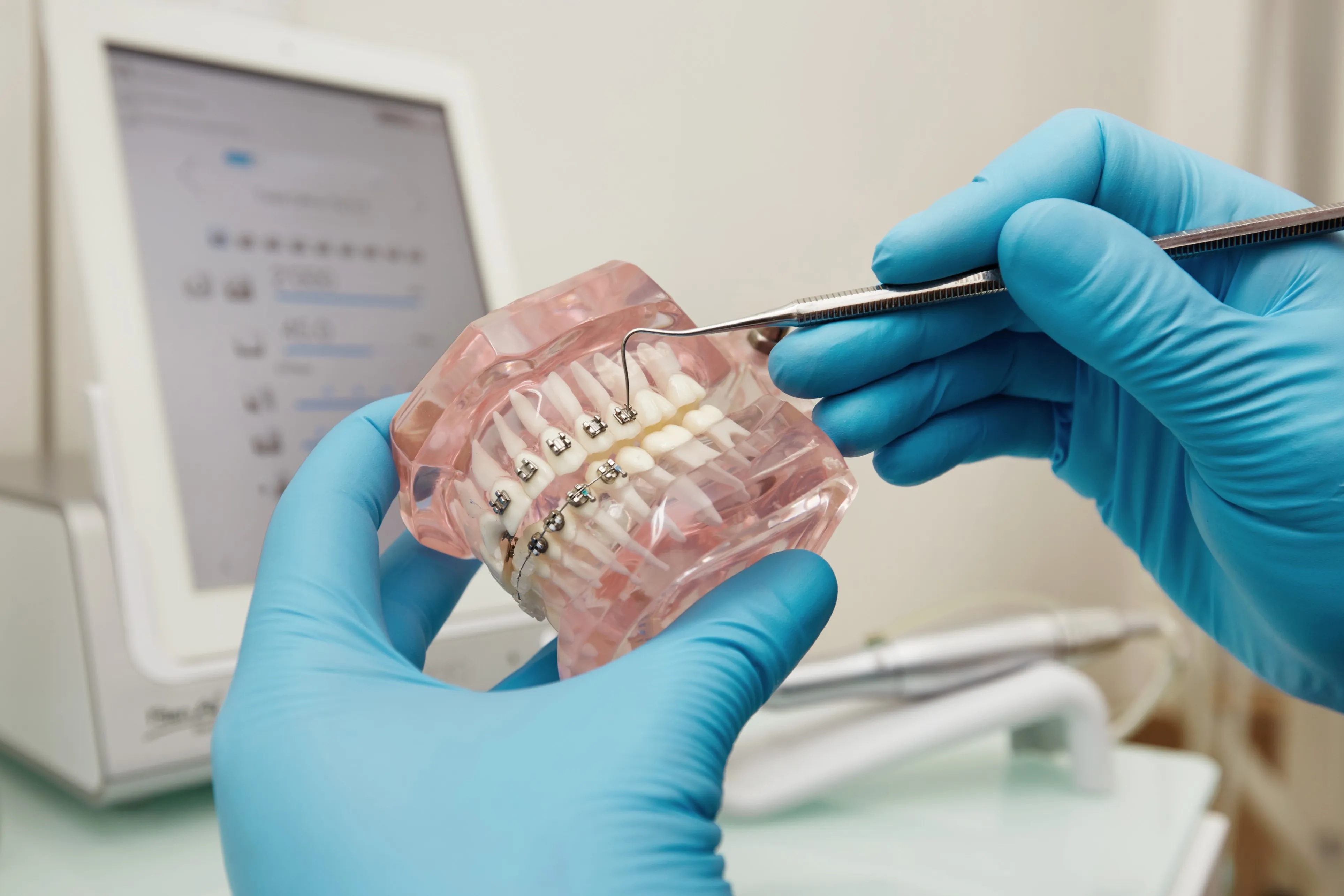 Orthodontiste Strasbourg 67000